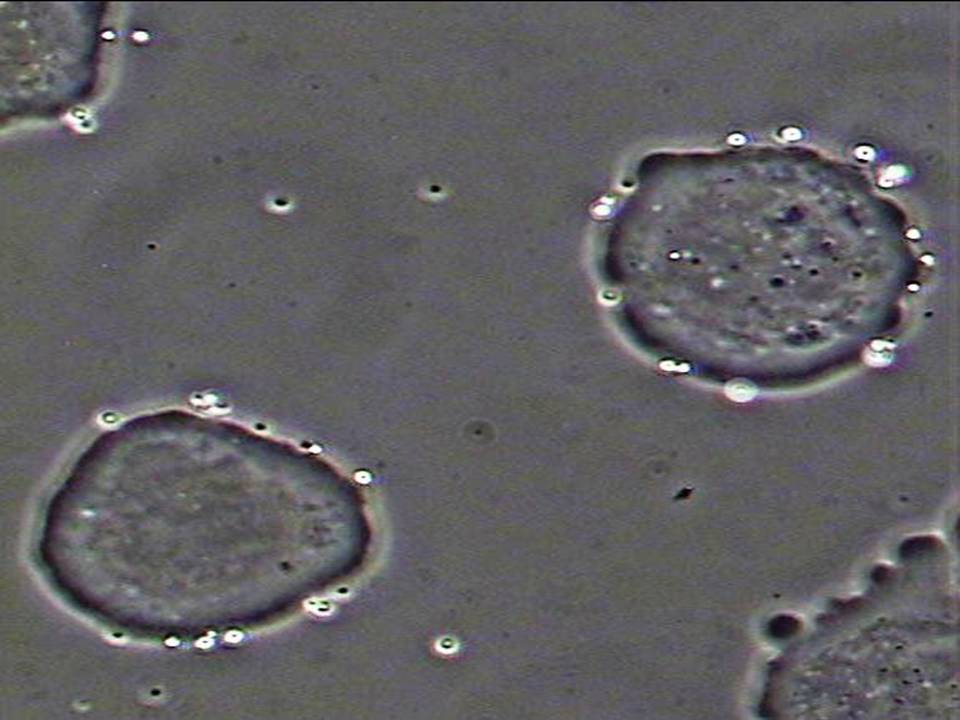 Biotinylated cationic microbubbles attached on cells x100 magnification Biotinylated cationic microbubbles attached on cells x100 magnification